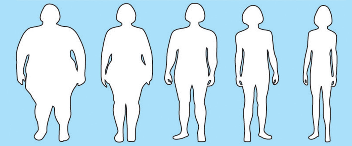 Obezite-ve-şişman-kilo-verme-yöntemleri Obezite-ve-şişman-kilo-verme-yöntemleri