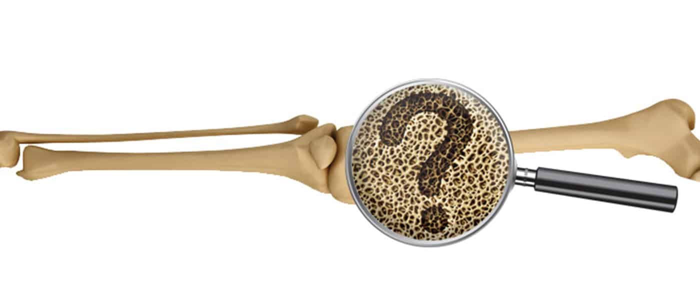 Osteoporosis-kemik-erimesi-hastalıgı Osteoporosis-kemik-erimesi-hastalıgı